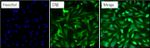 Estrogen Receptor beta Antibody in Immunocytochemistry (ICC/IF)