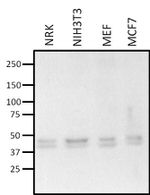 Estrogen Receptor beta Antibody in Western Blot (WB)