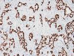 ER Antibody in Immunohistochemistry (Paraffin) (IHC (P))