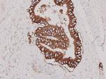 HER2/ErbB2 Antibody in Immunohistochemistry (Paraffin) (IHC (P))