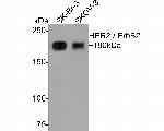 HER2/ErbB2 Antibody in Western Blot (WB)
