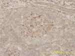Bcl-2 Antibody in Immunohistochemistry (Paraffin) (IHC (P))