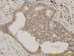 Bcl-2 Antibody in Immunohistochemistry (Paraffin) (IHC (P))