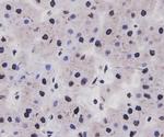 Cyclin D1 Antibody in Immunohistochemistry (Paraffin) (IHC (P))