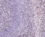 Cyclin D1 Antibody in Immunohistochemistry (Paraffin) (IHC (P))