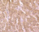 Glut-1 Antibody in Immunohistochemistry (Paraffin) (IHC (P))