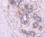 Glut-1 Antibody in Immunohistochemistry (Paraffin) (IHC (P))