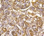 GRP94 Antibody in Immunohistochemistry (Paraffin) (IHC (P))