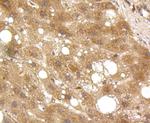 GRP94 Antibody in Immunohistochemistry (Paraffin) (IHC (P))