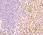 TLR4 Antibody in Immunohistochemistry (Paraffin) (IHC (P))