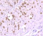 Ki67 Antibody in Immunohistochemistry (Paraffin) (IHC (P))