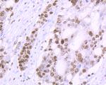 Ki67 Antibody in Immunohistochemistry (Paraffin) (IHC (P))