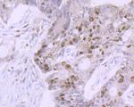 Ki67 Antibody in Immunohistochemistry (Paraffin) (IHC (P))