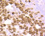 Ki67 Antibody in Immunohistochemistry (Paraffin) (IHC (P))