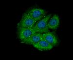 Bcl-2 Antibody in Immunocytochemistry (ICC/IF)