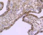 Bcl-2 Antibody in Immunohistochemistry (Paraffin) (IHC (P))