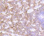 Bcl-2 Antibody in Immunohistochemistry (Paraffin) (IHC (P))
