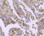 Bcl-2 Antibody in Immunohistochemistry (Paraffin) (IHC (P))
