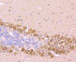 GRP78 Antibody in Immunohistochemistry (Paraffin) (IHC (P))