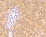 JAK2 Antibody in Immunocytochemistry (ICC/IF)