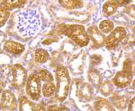 JAK2 Antibody in Immunohistochemistry (Paraffin) (IHC (P))