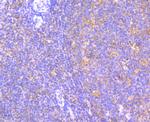 JAK2 Antibody in Immunohistochemistry (Paraffin) (IHC (P))