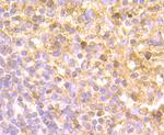 IL-8 Antibody in Immunohistochemistry (Paraffin) (IHC (P))