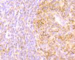IL-8 Antibody in Immunohistochemistry (Paraffin) (IHC (P))