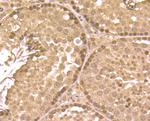 GAPDH Antibody in Immunohistochemistry (Paraffin) (IHC (P))
