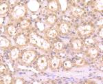 LSD1 Antibody in Immunohistochemistry (Paraffin) (IHC (P))