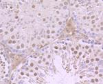 Progesterone Receptor Antibody in Immunohistochemistry (Paraffin) (IHC (P))