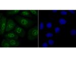 Progesterone Receptor Antibody in Immunocytochemistry (ICC/IF)