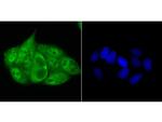 Progesterone Receptor Antibody in Immunocytochemistry (ICC/IF)
