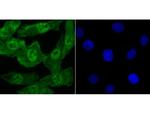 Progesterone Receptor Antibody in Immunocytochemistry (ICC/IF)