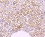 Cytokeratin 8 Antibody in Immunohistochemistry (Paraffin) (IHC (P))