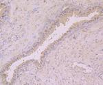 Cytokeratin 8 Antibody in Immunohistochemistry (Paraffin) (IHC (P))