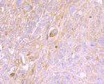 Cytokeratin 8 Antibody in Immunohistochemistry (Paraffin) (IHC (P))