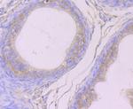 Cytokeratin 8 Antibody in Immunohistochemistry (Paraffin) (IHC (P))