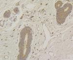 Raptor Antibody in Immunohistochemistry (Paraffin) (IHC (P))