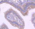 CD36 Antibody in Immunohistochemistry (Paraffin) (IHC (P))