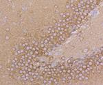 Dynamin 1 Antibody in Immunohistochemistry (Paraffin) (IHC (P))