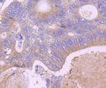 EpCAM Antibody in Immunohistochemistry (Paraffin) (IHC (P))