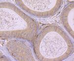 EpCAM Antibody in Immunohistochemistry (Paraffin) (IHC (P))
