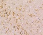 IP3 Receptor Antibody in Immunohistochemistry (Paraffin) (IHC (P))