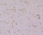 IP3 Receptor Antibody in Immunohistochemistry (Paraffin) (IHC (P))