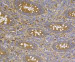 CASK Antibody in Immunohistochemistry (Paraffin) (IHC (P))