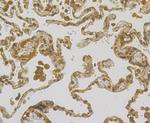 Mesothelin Antibody in Immunohistochemistry (Paraffin) (IHC (P))