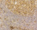 Mesothelin Antibody in Immunohistochemistry (Paraffin) (IHC (P))