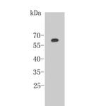Estrogen Receptor alpha Antibody in Western Blot (WB)