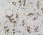 Cytokeratin 17 Antibody in Immunohistochemistry (Paraffin) (IHC (P))
